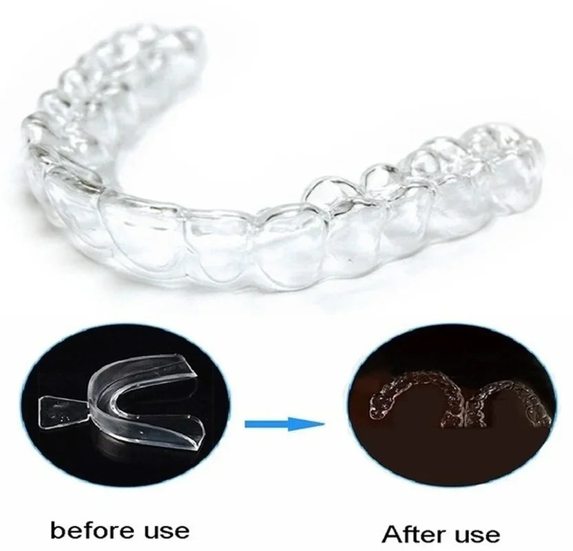 Silicone Retainer/Mouth Guard Teeth Protector Night Guard Mouth Tray for Bruxism Grinding Protection